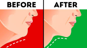 The pressing force should gradually increase. 6 Effective Ways To Get Rid Of A Double Chin Youtube