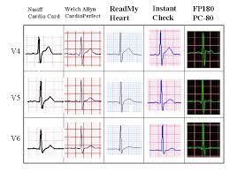 1 Lead To 12 Lead And Exercise Ecg