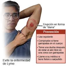 Maybe you would like to learn more about one of these? Enfermedad De Lyme Aftercare Instructions Care Guide Information En Espanol