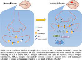 Focal Cerebral Ischemia And Reperfusion Induce Brain Injury Through A2d 1 Bound Nmda Receptors Stroke