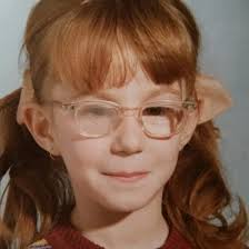 Lynn Worrall before and after. Left Deyes 1976