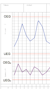 Werden, also entfällt auch die berechnung des cp. Https Umsetzer Com Wp Content Uploads 2016 12 Statistical Process Control Pdf