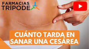 Cesarea Cuanto Tiempo Toma Recuperarse Cuanto Tarda En Sanar Una Cesarea Youtube