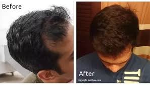 Warm 1 tablespoon of organic coconut oil until it is comfortable to touch. How To Mix Hair Oils For Hair Growth Quora