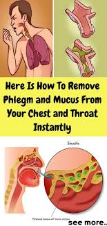 Here Is How To Remove Phlegm And Mucus From Your Chest And Throat Instantly Mucus In Throat Mucus Mucus Relief
