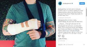 Edward christopher sheeran mbe (/ˈʃɪərən/; Showbiz Ed Sheeran S Concert In Kl Next Month May Just Be Cancelled Due To His Broken Arm