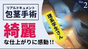 YouTube動画】理系学生さん 綺麗な仕上がりに感動！ | 包茎手術リアルドキュメント カルテNo,1｜メンズ美容TV by セイコメディカル |  鹿児島・福岡・東京 男性治療専門外来 セイコメディカルビューティクリニック