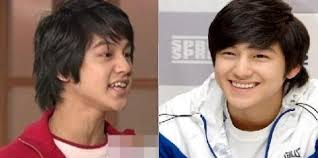 Những ngôi sao làm răng sứ giúp đổi mới nụ cười