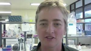 Virological features associated with the development of broadly  neutralizing antibodies to HIV-1