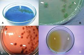 Image result for Rhizobium radiobacter, syn. Agrobacterium tumefaciens