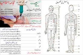 Hijama Or Cupping Therapy Sunnah Points On Human Body