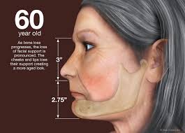 Hidden Consequences of Losing Teeth