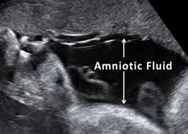 We did not find results for: When In Doubt Go Check It Out Leaking Amniotic Fluid