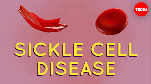 Sickle cell disease is an inherited blood disorder. How This Disease Changes The Shape Of Your Cells Amber M Yates Youtube