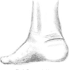 As an aneurysm grows it can become so thin that it leaks or ruptures, releasing blood into the spaces around the brain. Figure 2 From Cincinnati Incision Approach For Posterior Ankle And Calcaneal Pathology Technique Tip Semantic Scholar