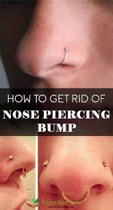 How To Get Rid Of Nose Piercing Bump Bump Noisepiercingbump Nose Piercing Rid Bump Piercing Bump Nose Piercing Bump Nose Piercing