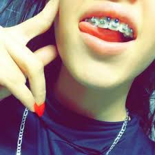 The jewellery goes through the lower frenulum for this type of oral piercing, making the piercing just peek over the lower lip of the wearer. Smiley Piercing 50 Ideas Pain Level Healing Time Cost Experience Piercee