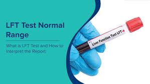 Image result for Liver Function Test