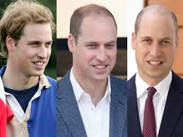 This doesn't affect hair growth in any way, neither positively. It Was Time For Prince William To Finally Shave His Balding Head