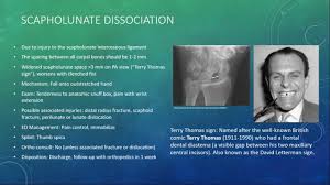 Image result for Scapholunate Dislocation