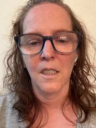 Fundraiser by Brenda Nelson : Help Brenda eat and have confidence again  please