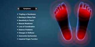 Image result for Peripheral Neuropathy