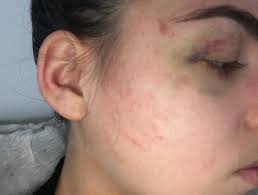 Multiple Temple students attacked and robbed by violent mob