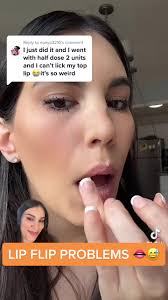 Understanding the Lip Flip Procedure and Common Issues