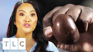 Season 101 • episode 1. Dr Sandra Lee Inspects Ginormous Mass On Man S Finger Dr Pimple Popper Youtube