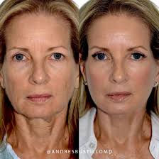 Andres Bustillo, MD, FACS