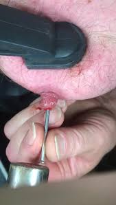 Bdsmm: Long nail in nipple - ThisVid.com