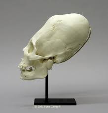 Ancient Elongated Skulls Alien Remains Dr Michael Heiser Check out our elongated head selection for the very best in unique or custom, handmade pieces did you scroll all this way to get facts about elongated head? dr michael heiser