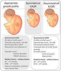 Frontiers Knowledge Gaps And Emerging Research Areas In Intrauterine Growth Restriction Associated Brain Injury Endocrinology