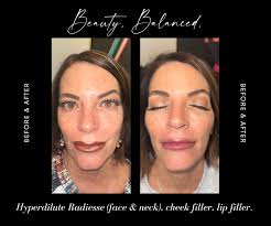 Check Out Jason Badgett's Story