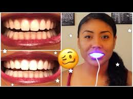 Read smiledirectclub reviews by real customers and learn more about the clear aligner treatment process, nighttime aligners, total cost, and whether or not customers recommend this company. Smile Direct Club Reviews Does It Really Straighten Teeth