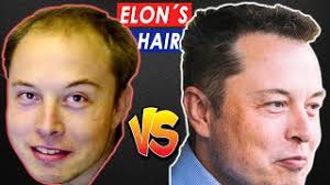 Sont sur ebay ✓ comparez les prix et les spécificités des produits neufs et d'occasion ✓ pleins d'articles en livraison gratuite! Elon Musk Hair Transplant History And Hair Analysis Before And After