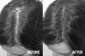 Our serum contains the highest levels of nanogen hair growth factors available. Nanogen Nanogenproducts Profile Pinterest