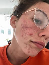 God truly has blessed me with a lot in life, and this is definitely part of  that. I'm so excited to go through life with you 🤍💍