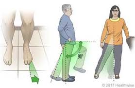 Your problem could be fai: Hip Replacement Posterior Precautions What To Expect At Home
