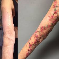 But you may still wish to make them more meaningful there are many other designs that you can consider for your surgery scars. Tattoos Over Scars Tattoos Gallery