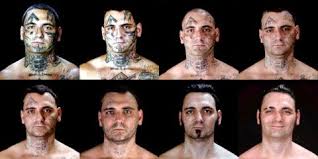 Laser tattoo removal is a very thorough process. Can You Get Laser Tattoo Removal On Your Face Or Neck