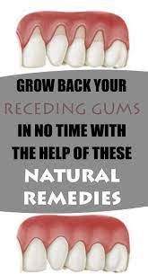 Grow Back Your Receding Gums In No Time With The Help Of These Natural Remedies Receding Gums Gum Health Grow Back Receding Gums