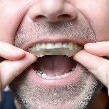 Image result for Occlusal