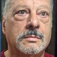 Swifties win lawsuit news