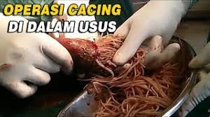 Check spelling or type a new query. Cacing Manusia Apakah Punca Gejala Lain Lain 2021