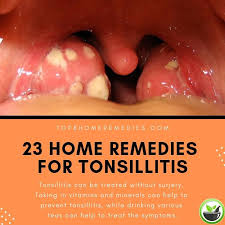 Home Remedies For Tonsillitis Tonsilitis Remedy Strep Throat Remedies Strep Throat Remedies Natural