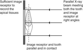 Periapical Radiography Pocket Dentistry