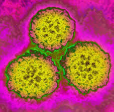 It's the most common kind of sexually transmitted infection. Was Ist Hpv Und Lost Es Krebs Aus Podcast Welt