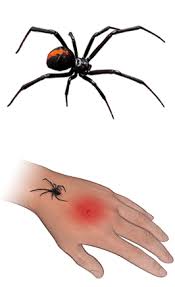 If you can't get medical attention, don't google black widow bite. Spider Bites Johns Hopkins Medicine