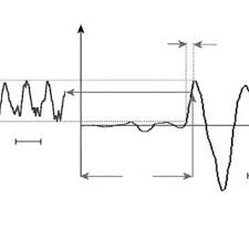 An uwb radar based stealthy 'lie detector'. Pdf An Uwb Radar Based Stealthy Lie Detector